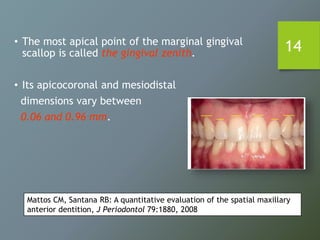 14• The most apical point of the marginal gingival
scallop is called the gingival zenith.
• Its apicocoronal and mesiodistal
dimensions vary between
0.06 and 0.96 mm.
Mattos CM, Santana RB: A quantitative evaluation of the spatial maxillary
anterior dentition, J Periodontol 79:1880, 2008
 