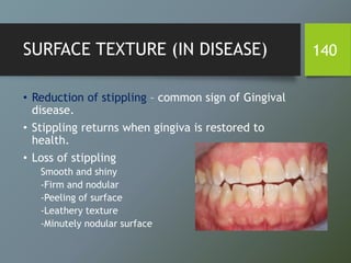 SURFACE TEXTURE (IN DISEASE)
• Reduction of stippling – common sign of Gingival
disease.
• Stippling returns when gingiva is restored to
health.
• Loss of stippling
Smooth and shiny
-Firm and nodular
-Peeling of surface
-Leathery texture
-Minutely nodular surface
140
 