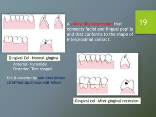 19
Gingival Col- Normal gingiva
Gingival col- After gingival recession
Anterior- Pyramidal
Posterior- Tent shaped
A valley-like depression that
connects facial and lingual papilla
and that conforms to the shape of
interproximal contact.
Col is covered by non-keratinized
stratified squamous epithelium
 