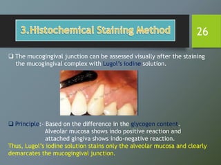 26
 The mucogingival junction can be assessed visually after the staining
the mucogingival complex with Lugol’s iodine solution.
 Principle:- Based on the difference in the glycogen content.
Alveolar mucosa shows indo positive reaction and
attached gingiva shows indo-negative reaction.
Thus, Lugol’s iodine solution stains only the alveolar mucosa and clearly
demarcates the mucogingival junction.
 
