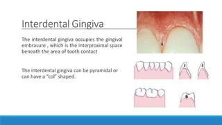 Interdental Gingiva
The interdental gingiva occupies the gingival
embrasure , which is the interproximal space
beneath the area of tooth contact
The interdental gingiva can be pyramidal or
can have a “colˮ shaped.
 