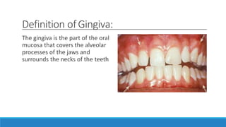 Definition ofGingiva:
The gingiva is the part of the oral
mucosa that covers the alveolar
processes of the jaws and
surrounds the necks of the teeth
 