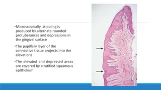 •Microscopically ,stippling is
produced by alternate rounded
protuberances and depressions in
the gingival surface
•The papillary layer of the
connective tissue projects into the
elevations
•The elevated and depressed areas
are covered by stratified squamous
epithelium
 
