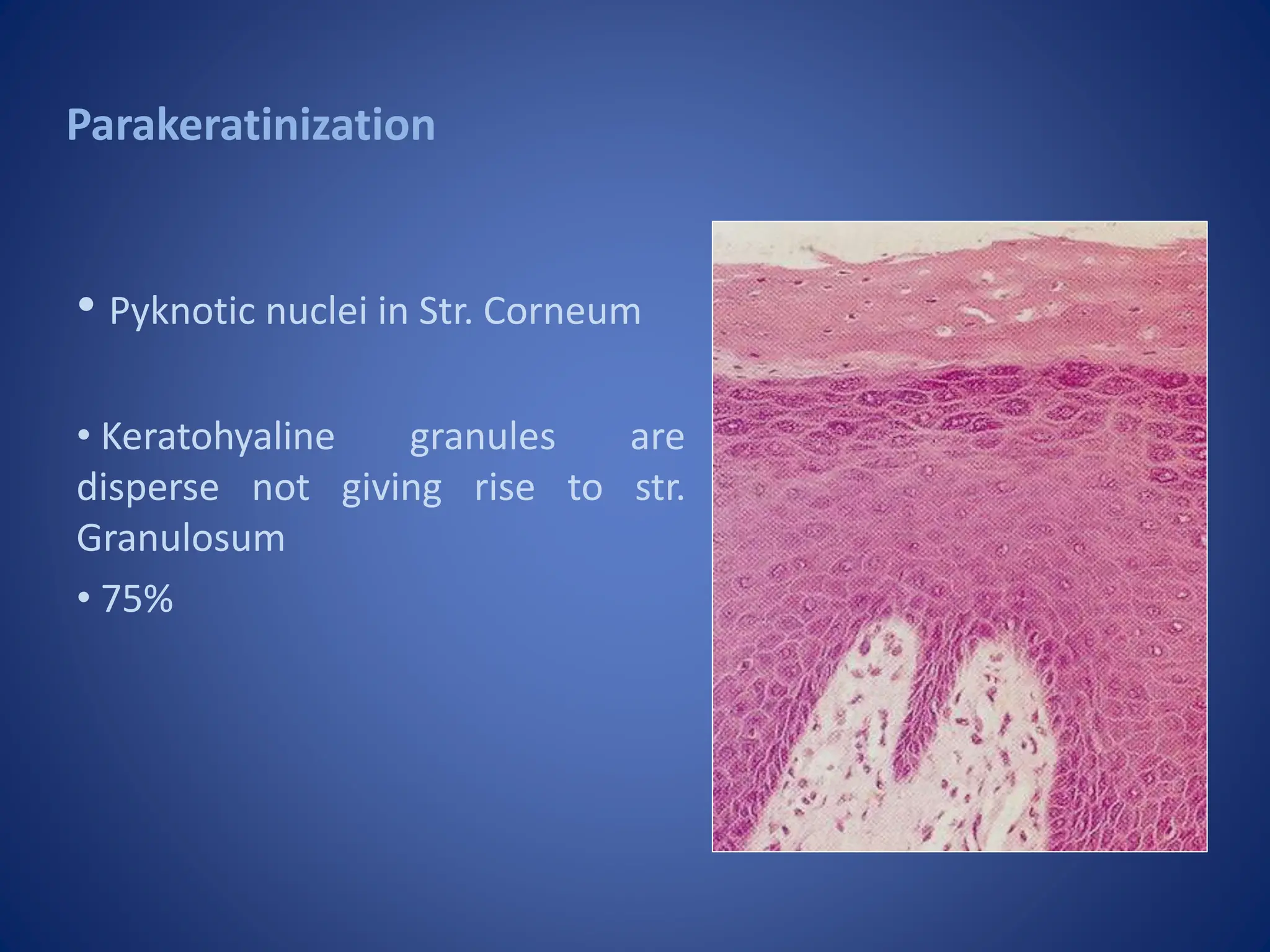 Anatomy of gingival microscopy and gingival epithelium | PPTX