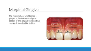Marginal Gingiva
The marginal , or unattached ,
gingiva is the terminal edge or
border of the gingiva surrounding
the teeth in collarlike fashion
 