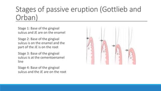 Stages of passive eruption (Gottlieb and
Orban)
Stage 1: Base of the gingival
sulcus and JE are on the enamel
Stage 2: Base of the gingival
sulcus is on the enamel and the
part of the JE is on the root
Stage 3: Base of the gingival
sulcus is at the cementoenamel
line
Stage 4: Base of the gingival
sulcus and the JE are on the root
 