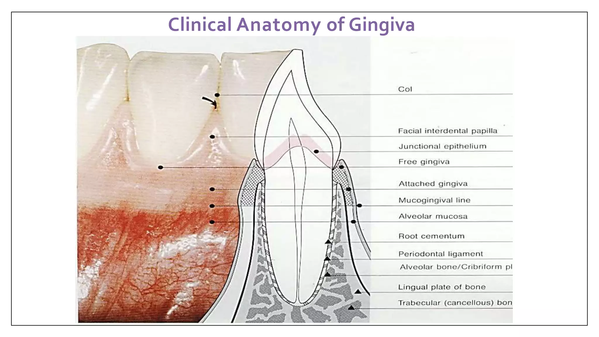 Gingiva Periodontology | PPTX