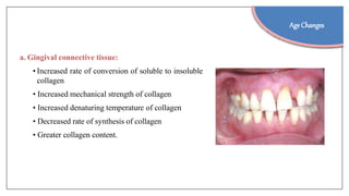 a. Gingival connective tissue:
• Increased rate of conversion of soluble to insoluble
collagen
• Increased mechanical strength of collagen
• Increased denaturing temperature of collagen
• Decreased rate of synthesis of collagen
• Greater collagen content.
Age Changes
 