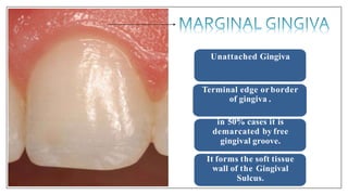 Unattached Gingiva
Terminal edge or border
of gingiva .
in 50% cases it is
demarcated by free
gingival groove.
It forms the soft tissue
wall of the Gingival
Sulcus.
 