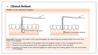 • Clinical Method
 