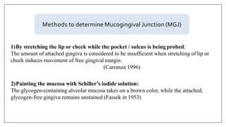 Methods to determine Mucogingival Junction (MGJ)
1)By stretching the lip or cheek while the pocket / sulcus is being probed:
The amount of attached gingiva is considered to be insufficient when stretching of lip or
cheek induces movement of free gingival margin.
(Carranza 1996)
2)Painting the mucosa with Schiller’s iodide solution:
The glycogen-containing alveolar mucosa takes on a brown color, while the attached,
glycogen-free gingiva remains unstained (Fassek in 1953)
 