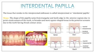 The tissue that resides in the interproximal embrasure is called interproximal or ‘interdental papilla’.
Shape: The shape of this papilla varies from triangular and knife-edge in the anterior regions due to
point-sized contacts of the teeth, to broader and more square-shaped tissue in the posterior sextants
due to the teeth having broad contact areas.
 
