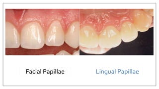 Facial Papillae Lingual Papillae
 