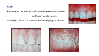 SIZE:
Sum total of the bulk of -cellular and intercellular elements
-and their vascular supply
Alteration of size is a common feature of gingival disease.
 