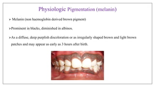 Physiologic Pigmentation (melanin)
 Melanin (non haemoglobin derived brown pigment)
Prominent in blacks, diminished in albinos.
As a diffuse, deep purplish discoloration or as irregularly shaped brown and light brown
patches and may appear as early as 3 hours after birth.
 