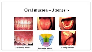 Oral mucosa – 3 zones :-
Masticatorymucosa Specialized mucosa Lining mucosa
 