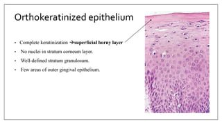 Orthokeratinized epithelium
• Complete keratinization superficial horny layer
• No nuclei in stratum corneum layer.
• Well-defined stratum granulosum.
• Few areas of outer gingival epithelium.
 