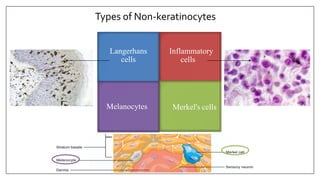 Langerhans
cells
Melanocytes Merkel's cells
NON-
KERATINOCYTES
Inflammatory
cells
Types of Non-keratinocytes
 