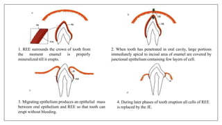 1. REE surrounds the crown of tooth from
the moment enamel is properly
mineralized till it erupts.
3. Migrating epithelium produces an epithelial mass
between oral epithelium and REE so that tooth can
erupt without bleeding.
2. When tooth has penetrated in oral cavity, large portions
immediately apical to incisal area of enamel are covered by
junctional epithelium containing few layers of cell.
4. During later phases of tooth eruption all cells of REE
is replaced by the JE.
 