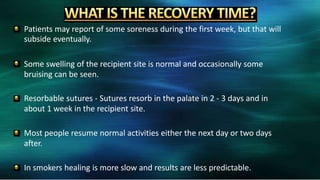 Patients may report of some soreness during the first week, but that will
subside eventually.
Some swelling of the recipient site is normal and occasionally some
bruising can be seen.
Resorbable sutures - Sutures resorb in the palate in 2 - 3 days and in
about 1 week in the recipient site.
Most people resume normal activities either the next day or two days
after.
In smokers healing is more slow and results are less predictable.
 