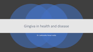 Dr. Lakkireddy Vasavi reddy
Gingiva in health and disease
 