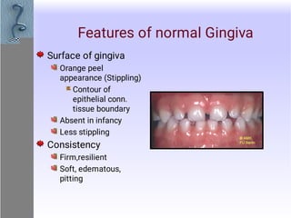 Normal Gingiva Gingival and Periodontal diseases periodontology | PDF