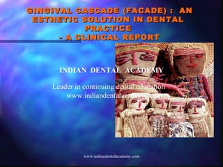 GINGIVAL CASCADE (FACADE) : ANGINGIVAL CASCADE (FACADE) : AN
ESTHETIC SOLUTION IN DENTALESTHETIC SOLUTION IN DENTAL
PRACTICEPRACTICE
- A CLINICAL REPORT- A CLINICAL REPORT
INDIAN DENTAL ACADEMY
Leader in continuing dental education
www.indiandentalacademy.com
www.indiandentalacademy.com
 