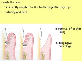 wash the area  ts is partly adapted to the tooth by gentle finger pr suturing and pack a. removal of pocket lining b. subgingival  curettage 