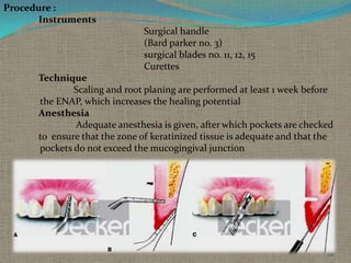 Procedure :
Instruments

Surgical handle
(Bard parker no. 3)
surgical blades no. 11, 12, 15
Curettes
Technique
Scaling and root planing are performed at least 1 week before
the ENAP, which increases the healing potential
Anesthesia
Adequate anesthesia is given, after which pockets are checked
to ensure that the zone of keratinized tissue is adequate and that the
pockets do not exceed the mucogingival junction

20

 