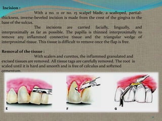 Incision :
With a no. 11 or no. 15 scalpel blade, a scalloped, partialthickness, inverse-beveled incision is made from the crest of the gingiva to the
base of the sulcus.
The incisions are carried facially, lingually, and
interproximally as far as possible. The papilla is thinned interproximally to
remove any inflammed connective tissue and the triangular wedge of
interproximal tissue. This tissue is difficult to remove once the flap is free.
Removal of the tissue :
With scalers and curettes, the inflammed granulated and
excised tissues are removed. All tissue tags are carefully removed. The root is
scaled until it is hard and smooth and is free of calculus and softened
cementum.

21

 