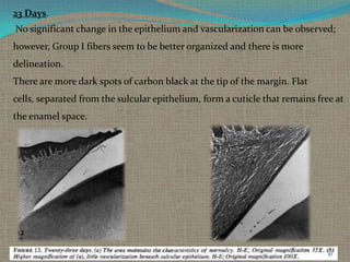 23 Days.
No significant change in the epithelium and vascularization can be observed;
however, Group I fibers seem to be better organized and there is more
delineation.
There are more dark spots of carbon black at the tip of the margin. Flat
cells, separated from the sulcular epithelium, form a cuticle that remains free at

the enamel space.

41

 