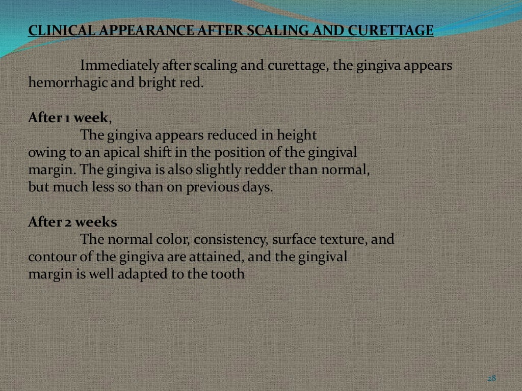 Gingival curettage