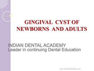 GINGIVAL CYST OF
NEWBORNS AND ADULTS
INDIAN DENTAL ACADEMY
Leader in continuing Dental Education
www.indiandentalacdemy.com
 