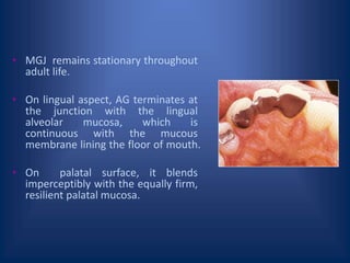 • MGJ remains stationary throughout
adult life.
• On lingual aspect, AG terminates at
the junction with the lingual
alveolar mucosa, which is
continuous with the mucous
membrane lining the floor of mouth.
• On palatal surface, it blends
imperceptibly with the equally firm,
resilient palatal mucosa.
 