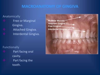 MACROANATOMY OF GINGIVA
Anatomically
 Free or Marginal
Gingiva.
 Attached Gingiva.
 Interdental Gingiva.
Functionally
 Part facing oral
cavity.
 Part facing the
tooth.
 