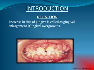 INTRODUCTION
DEFINITION
Increase in size of gingiva is called as gingival
enlargement (Gingival overgrowth).
Carranza’s 11 th edition
 