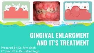 GINGIVAL ENLARGMENT
AND IT’S TREATMENT
Prepared By: Dr. Riya Shah
2nd year PG in Periodontology
 