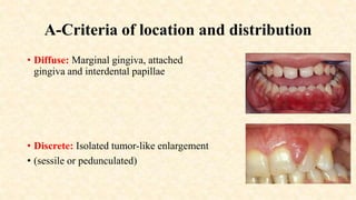 Gingival Enlargementdental periodontal.pptx