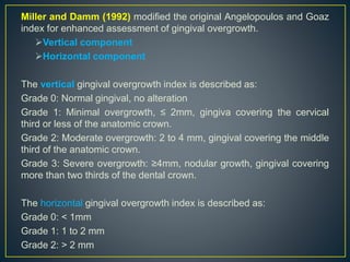 Bokenkamp A and Bohnhorst B (1994) categorized
gingival overgrowth dimensions into the following grades:
Grade 0: No signs...