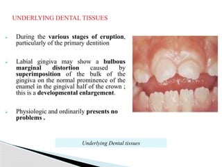 gingival enlargement 12.pptx department of periodontics | PPTX