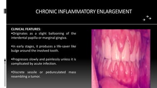 CHRONIC INFLAMMATORY ENLARGEMENT
CLINICAL FEATURES:
Originates as a slight ballooning of the
interdental papilla or marginal gingiva.
In early stages, it produces a life-saver like
bulge around the involved tooth.
Progresses slowly and painlessly unless it is
complicated by acute infection.
Discrete sessile or pedunculated mass
resembling a tumor.
 