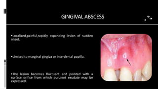 GINGIVAL ABSCESS
Localized,painful,rapidly expanding lesion of sudden
onset.
Limited to marginal gingiva or interdental papilla.
The lesion becomes fluctuant and pointed with a
surface orifice from which purulent exudate may be
expressed.
 