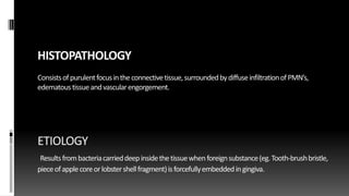 HISTOPATHOLOGY
Consistsofpurulentfocusintheconnectivetissue,surroundedbydiffuseinfiltrationofPMN’s,
edematoustissueandvascularengorgement.
ETIOLOGY
Resultsfrombacteriacarrieddeepinsidethetissuewhenforeignsubstance(eg.Tooth-brushbristle,
pieceofapplecoreorlobstershellfragment)isforcefullyembeddedingingiva.
 