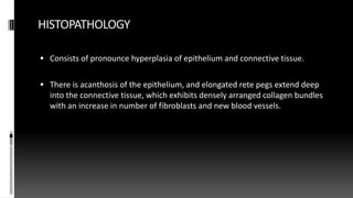 HISTOPATHOLOGY
 Consists of pronounce hyperplasia of epithelium and connective tissue.
 There is acanthosis of the epithelium, and elongated rete pegs extend deep
into the connective tissue, which exhibits densely arranged collagen bundles
with an increase in number of fibroblasts and new blood vessels.
 