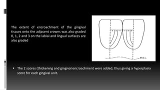  The 2 scores (thickening and gingival encroachment were added, thus giving a hyperplasia
score for each gingival unit.
The extent of encroachment of the gingival
tissues onto the adjacent crowns was also graded
0, 1, 2 and 3 on the labial and lingual surfaces are
also graded
 