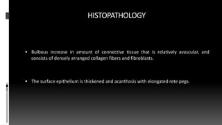 HISTOPATHOLOGY
 Bulbous increase in amount of connective tissue that is relatively avascular, and
consists of densely arranged collagen fibers and fibroblasts.
 The surface epithelium is thickened and acanthosis with elongated rete pegs.
 