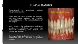 CLINICAL FEATURES
 Characterized by prominent bulbous
interproximal papillae.
 Often only the facial gingivae are enlarged,
and the lingual surfaces are relatively
unaltered because of the mechanical action of
the tongue.
 After puberty, the enlargement undergoes
spontaneous reduction, but does not
disappear completely until plaque and
calculus are removed.
 Capnocytophaga sp. have been shown to be
responsible for the initiation of pubertal
gingivitis.
 