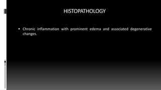 HISTOPATHOLOGY
 Chronic inflammation with prominent edema and associated degenerative
changes.
 