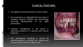 CLINICAL FEATURES
 The gingiva is bluish red and has a shiny surface.
 The consistency is moderately firm but there is
tendency towards friability and hemorrhage,
occurring spontaneously or on slight
provocation.
 Leukemic enlargement is not found in
edentulous patients or in patients with chronic
leukemia.
 The spontaneous bleeding is caused by
thrombocytopenia resulting from replacement
of bone marrow cells by leukemic cells.
 