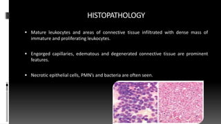 HISTOPATHOLOGY
 Mature leukocytes and areas of connective tissue infiltrated with dense mass of
immature and proliferating leukocytes.
 Engorged capillaries, edematous and degenerated connective tissue are prominent
features.
 Necrotic epithelial cells, PMN’s and bacteria are often seen.
 